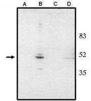 CHX10 Antibody in Western Blot (WB)