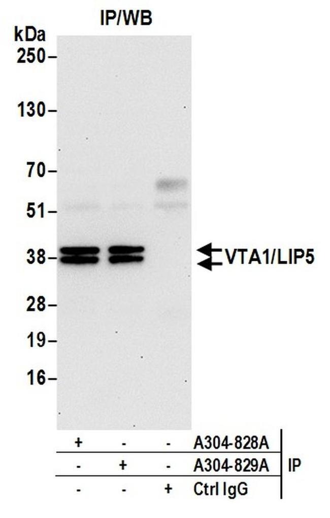 VTA1/LIP5 Antibody in Western Blot (WB)