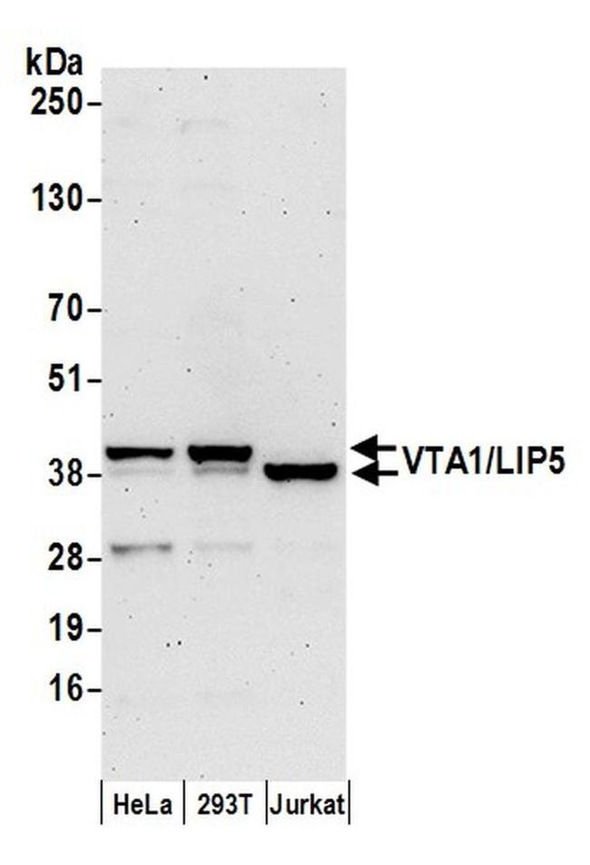 VTA1/LIP5 Antibody in Western Blot (WB)