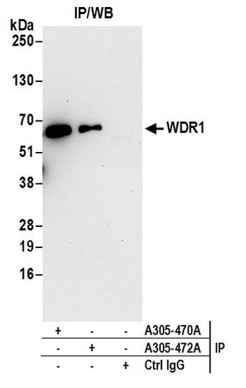 WDR1 Antibody in Immunoprecipitation (IP)