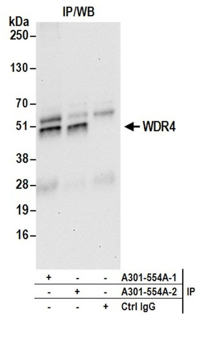 WDR4 Antibody in Immunoprecipitation (IP)
