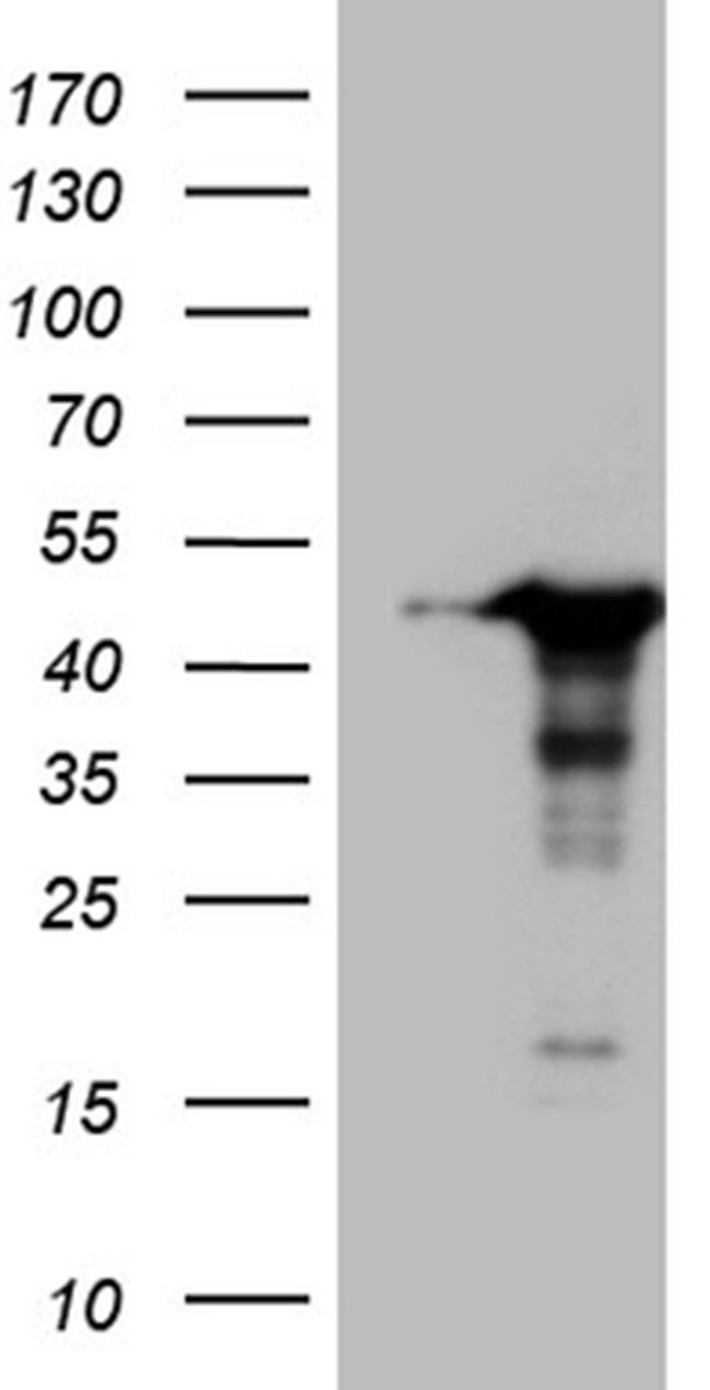 WDR92 Antibody in Western Blot (WB)