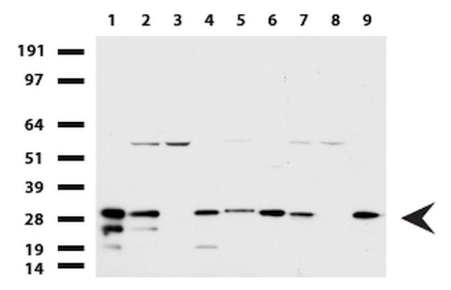 WIBG Antibody in Western Blot (WB)