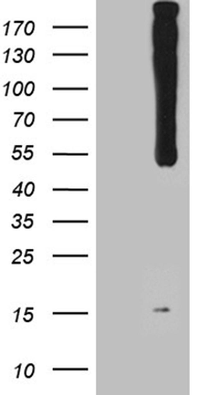 WIPI1 Antibody in Western Blot (WB)