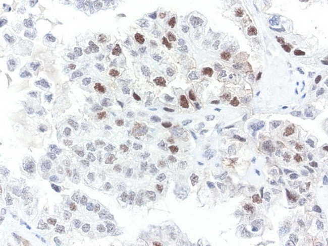 XPF Antibody in Immunohistochemistry (Paraffin) (IHC (P))
