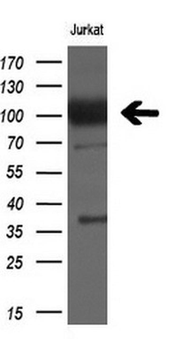 XPF Antibody in Western Blot (WB)