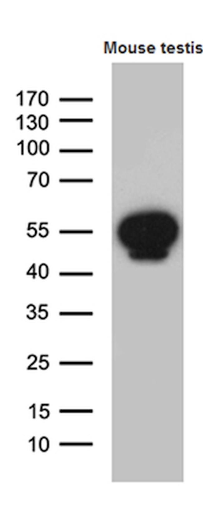 YBX2 Antibody in Western Blot (WB)