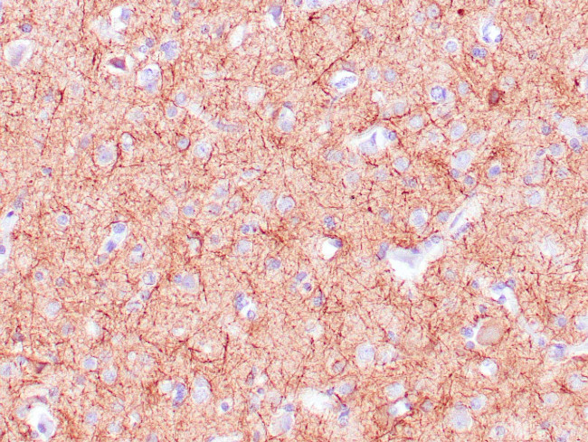 Neurofilament Antibody in Immunohistochemistry (Paraffin) (IHC (P))