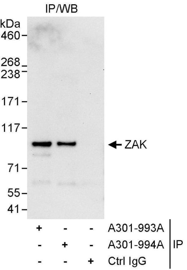 ZAK Antibody in Immunoprecipitation (IP)