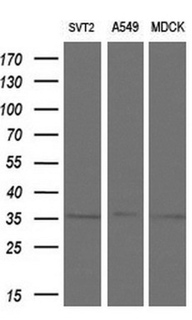 ZFP36 Antibody in Western Blot (WB)