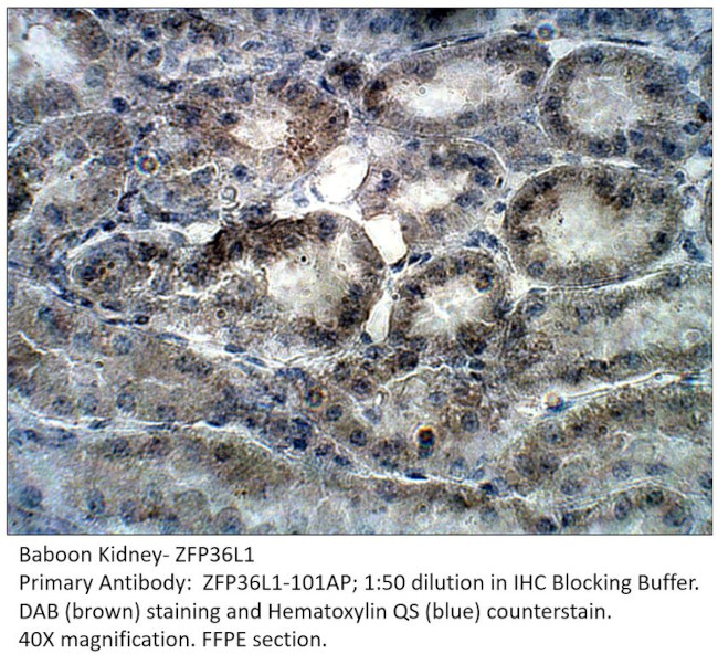 ZFP36L1 Antibody in Immunohistochemistry (IHC)