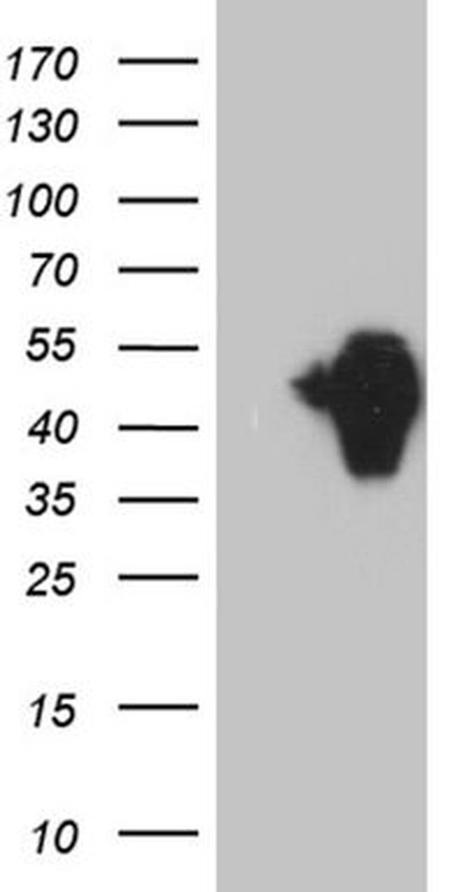 ZFP36L1 Antibody in Western Blot (WB)