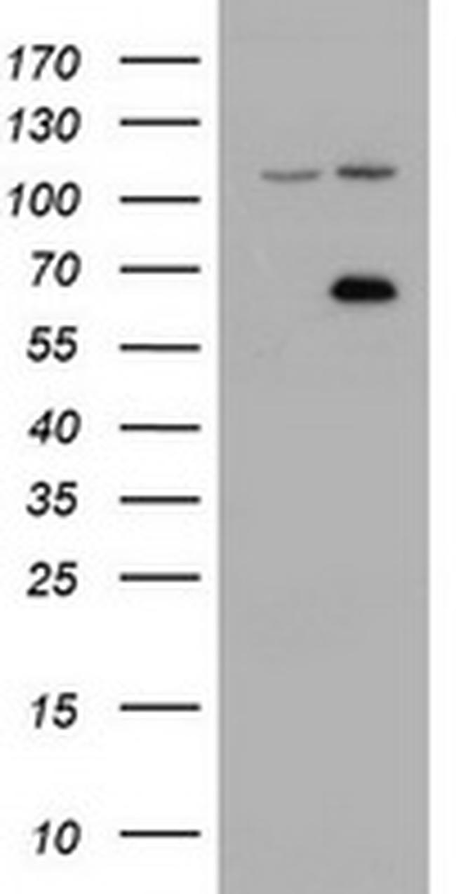 ZIM2 Antibody in Western Blot (WB)