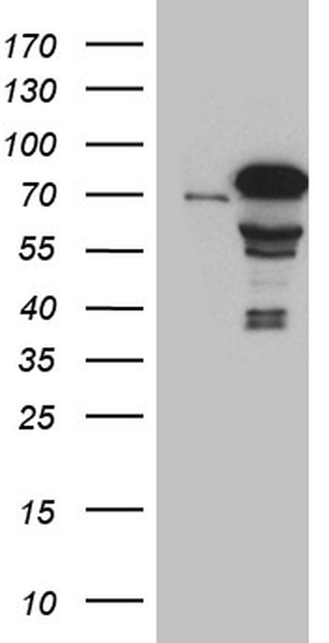 ZKSCAN1 Antibody in Western Blot (WB)