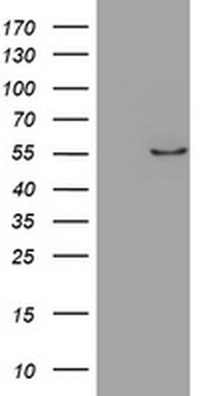 ZNF165 Antibody in Western Blot (WB)