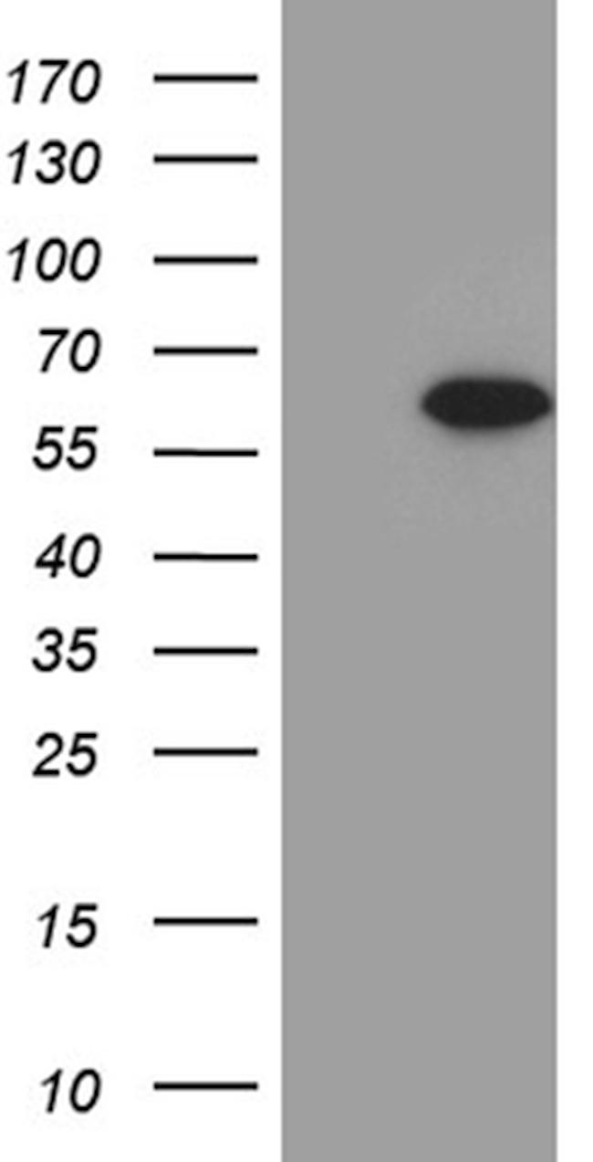 ZNF181 Antibody in Western Blot (WB)