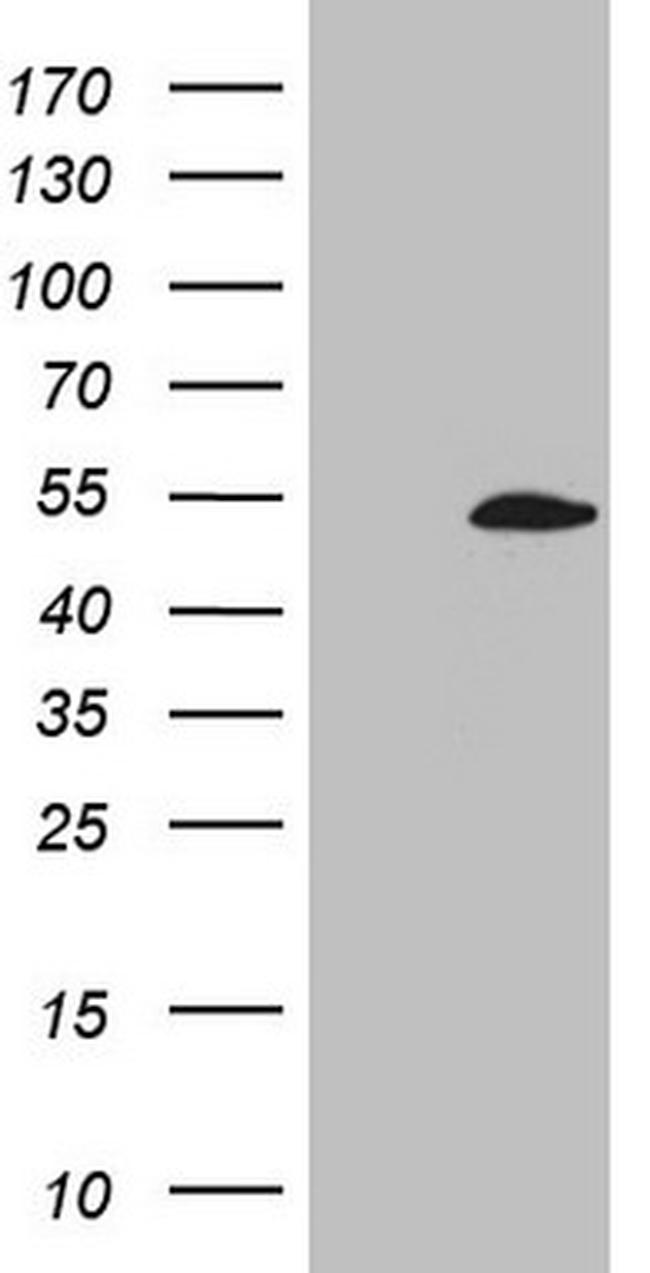 ZNF200 Antibody in Western Blot (WB)
