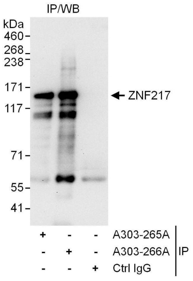 ZNF217 Antibody in Immunoprecipitation (IP)