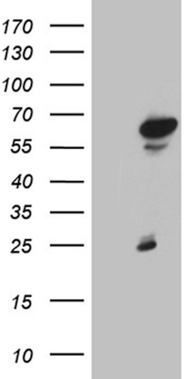 ZNF329 Antibody in Western Blot (WB)