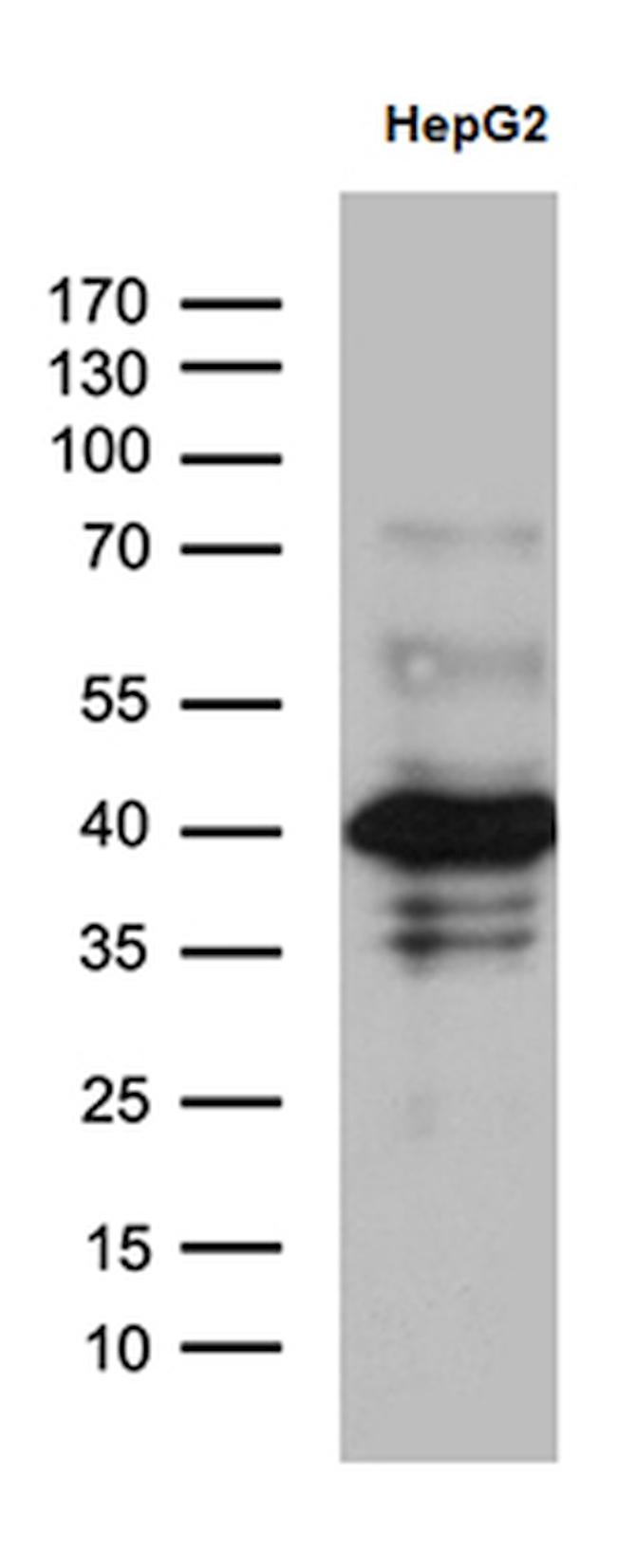 ZNF670 Antibody in Western Blot (WB)