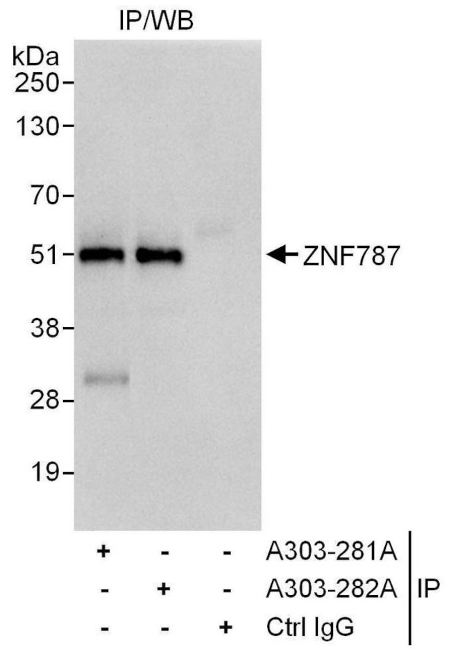 ZNF787 Antibody in Immunoprecipitation (IP)