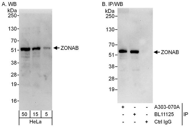 ZONAB Antibody in Western Blot (WB)