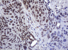 ZSCAN18 Antibody in Immunohistochemistry (Paraffin) (IHC (P))
