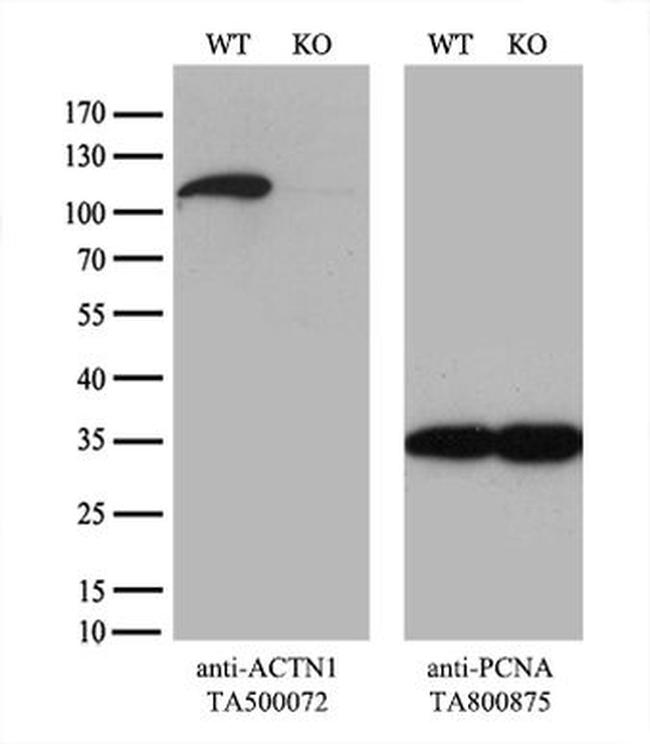alpha-actinin (Actinin alpha 1) Antibody in Western Blot (WB)