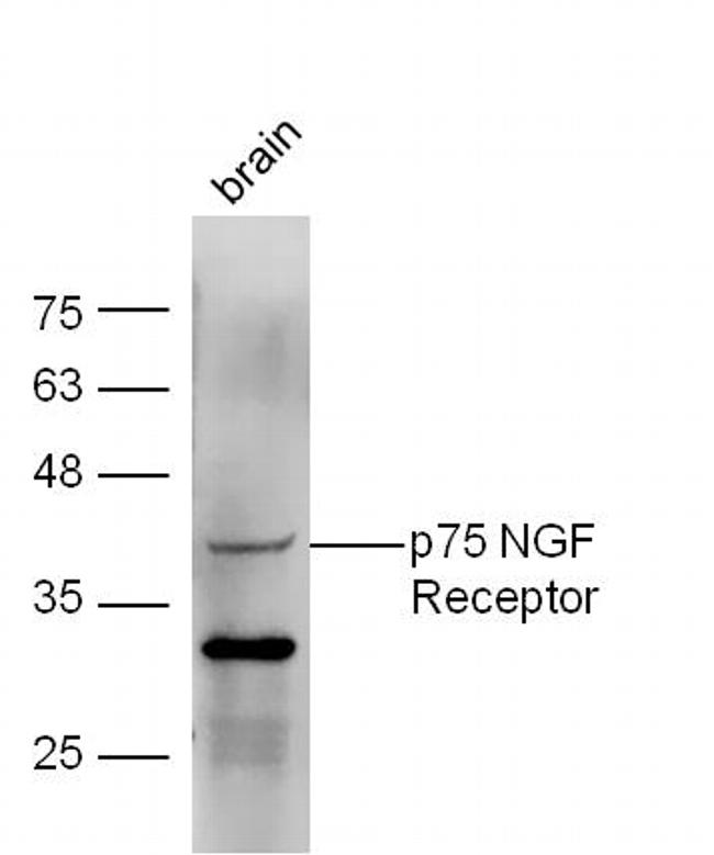 p75 NGF Receptor Antibody in Western Blot (WB)