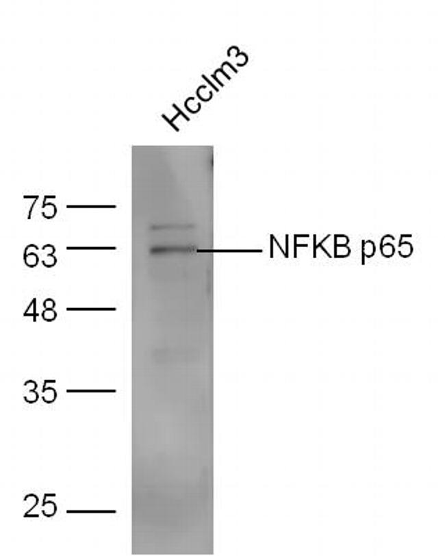 NFKB p65 Antibody in Western Blot (WB)