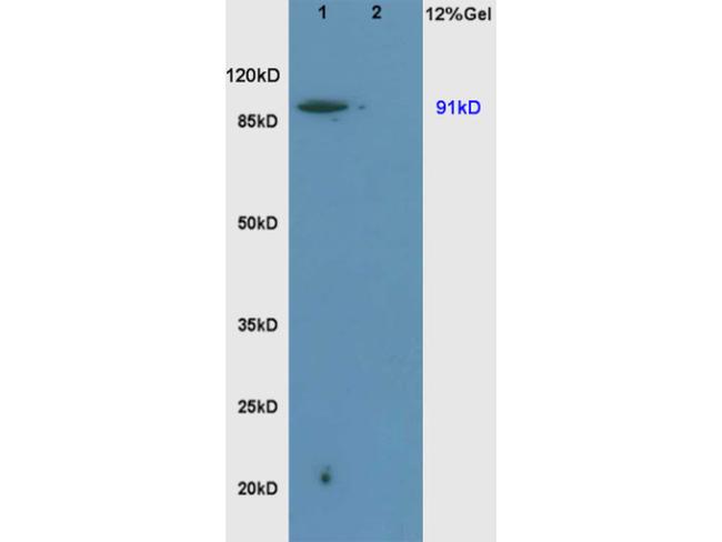 Sodium/Hydrogen Exchanger 1 Antibody in Western Blot (WB)