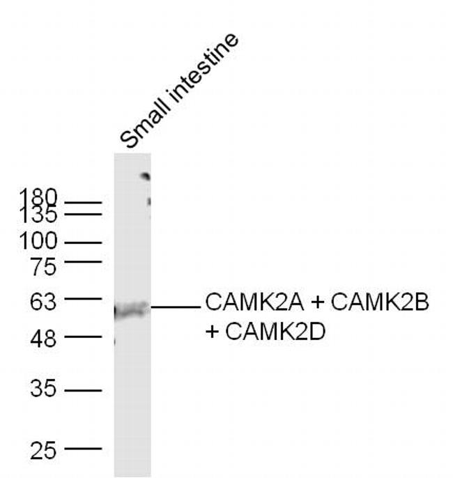 CaMK2 Antibody in Western Blot (WB)