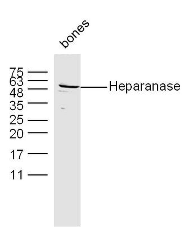 Heparanase Antibody in Western Blot (WB)