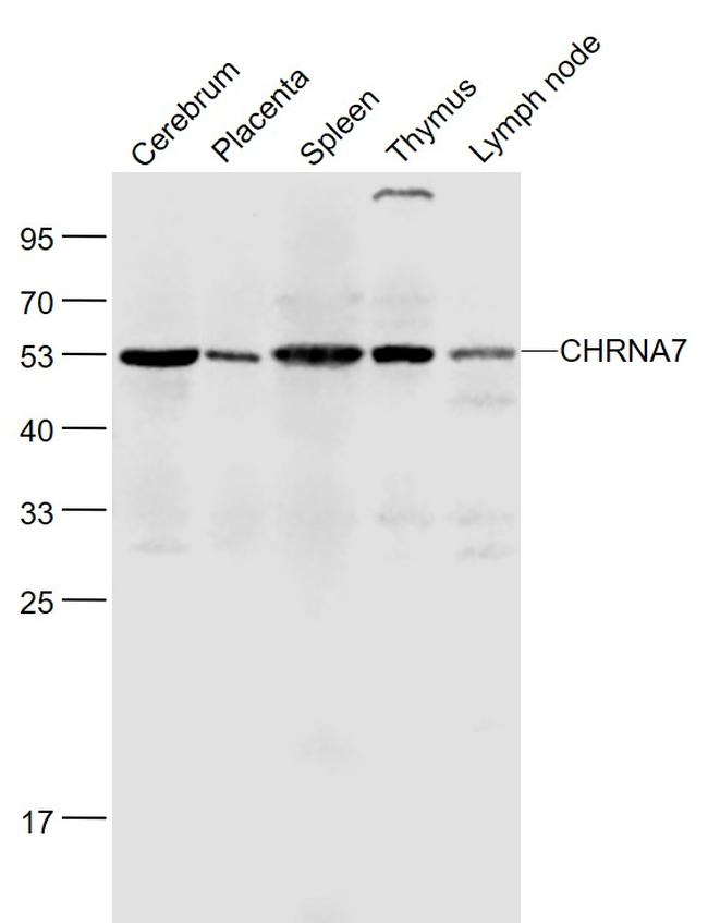 CHRNA7 Antibody in Western Blot (WB)