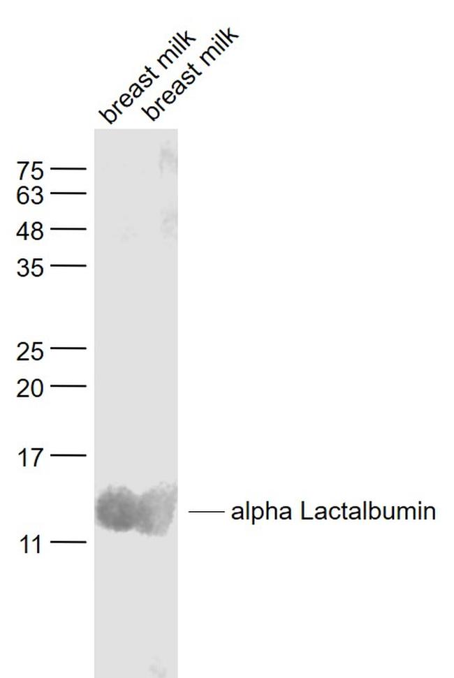 LALBA/alpha Lactalbumin Antibody in Western Blot (WB)