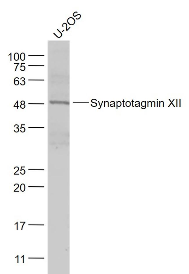 Synaptotagmin 12 Antibody in Western Blot (WB)
