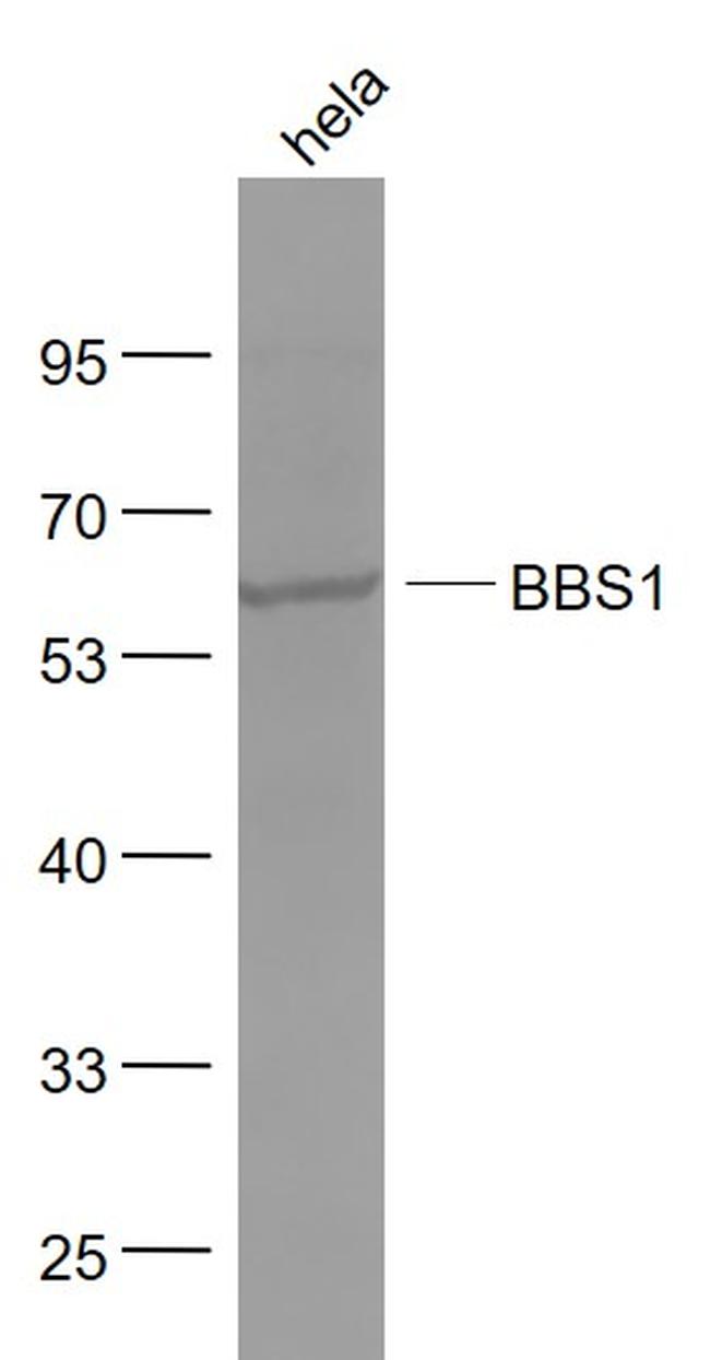 BBS1 Antibody in Western Blot (WB)