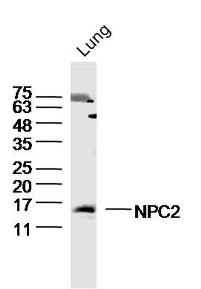 NPC2/Niemann Pick C2 Antibody in Western Blot (WB)