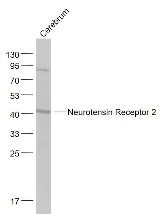 Neurotensin Receptor 2 Antibody in Western Blot (WB)