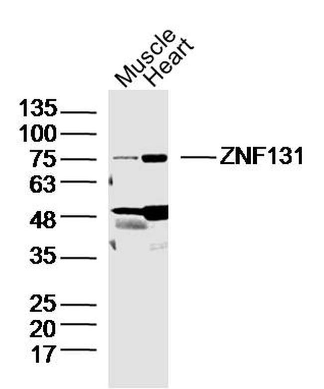 ZNF131 Antibody in Western Blot (WB)