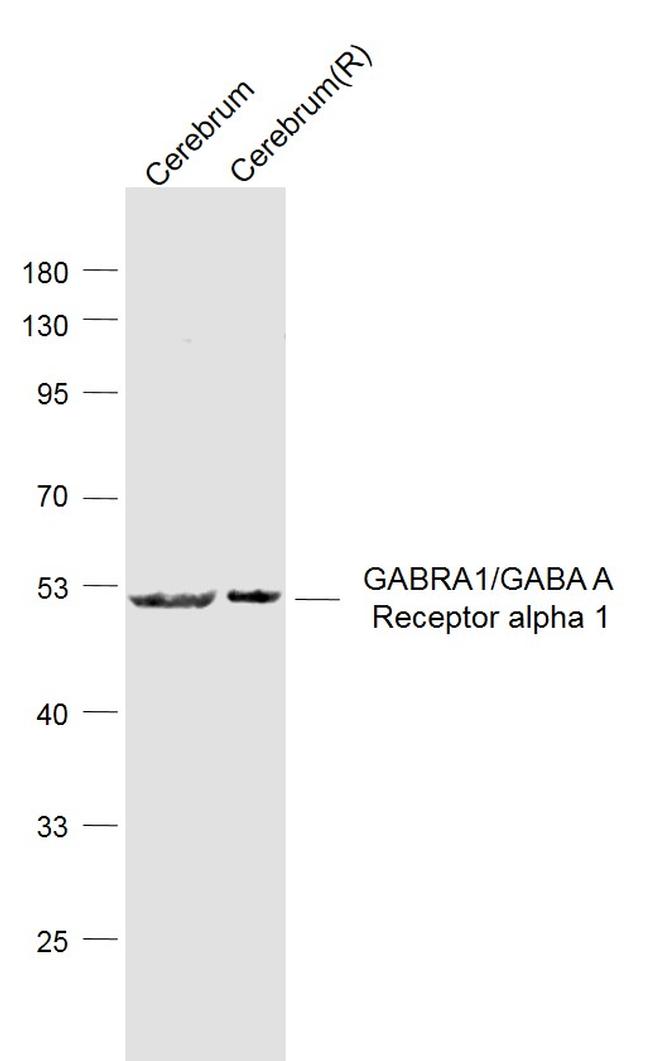 GABA A Receptor alpha 1 Antibody in Western Blot (WB)