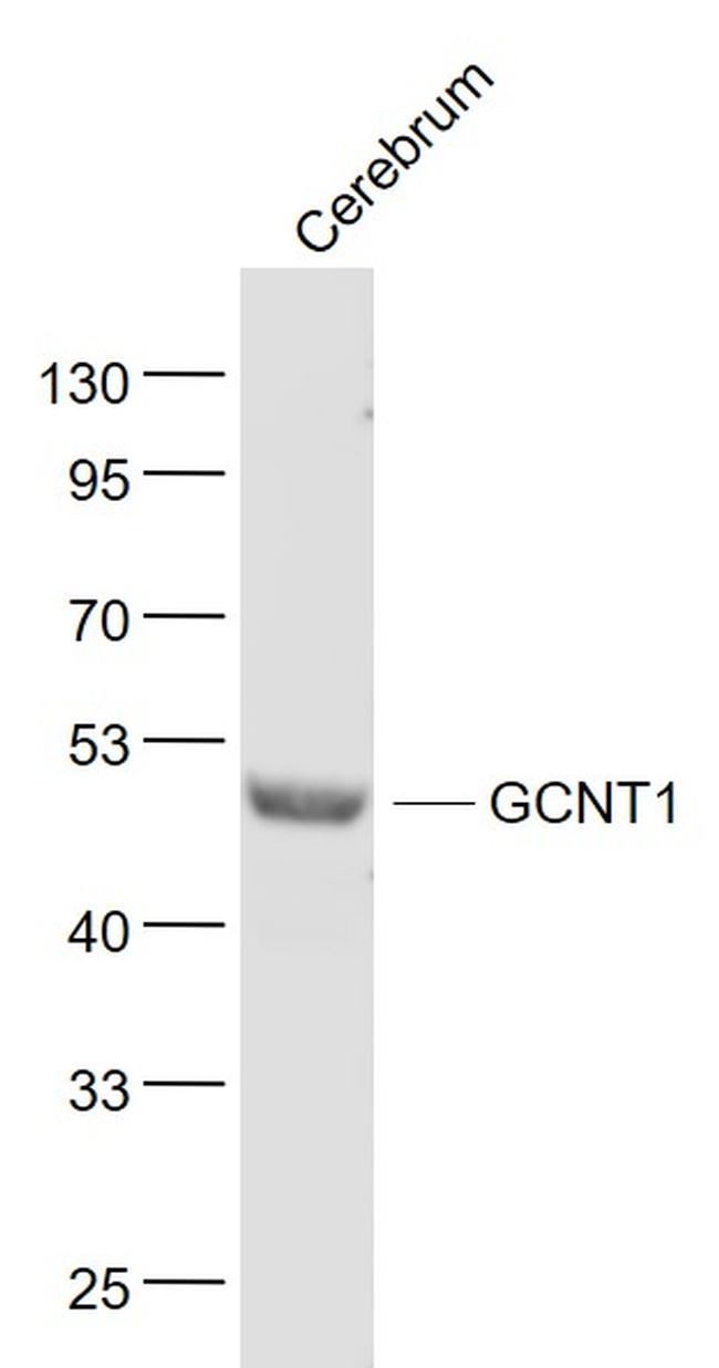 GCNT1 Antibody in Western Blot (WB)