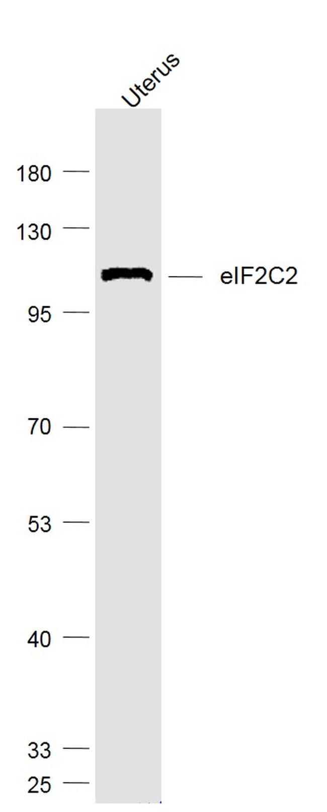 eIF2C2/Ago2 Antibody in Western Blot (WB)