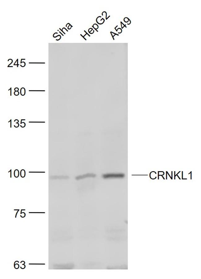 CRNKL1 Antibody in Western Blot (WB)
