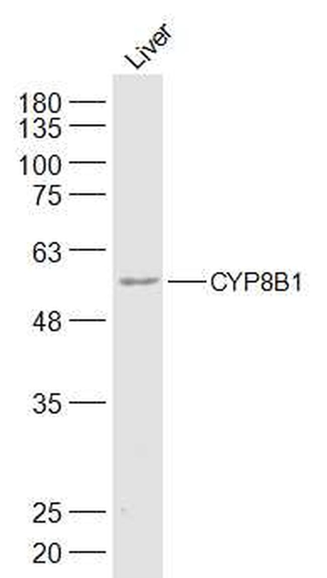 CYP8B1 Antibody in Western Blot (WB)