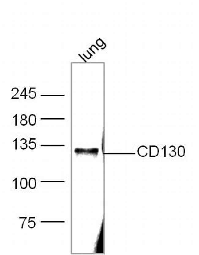 IL-6R Beta/CD130/gp130 Antibody in Western Blot (WB)