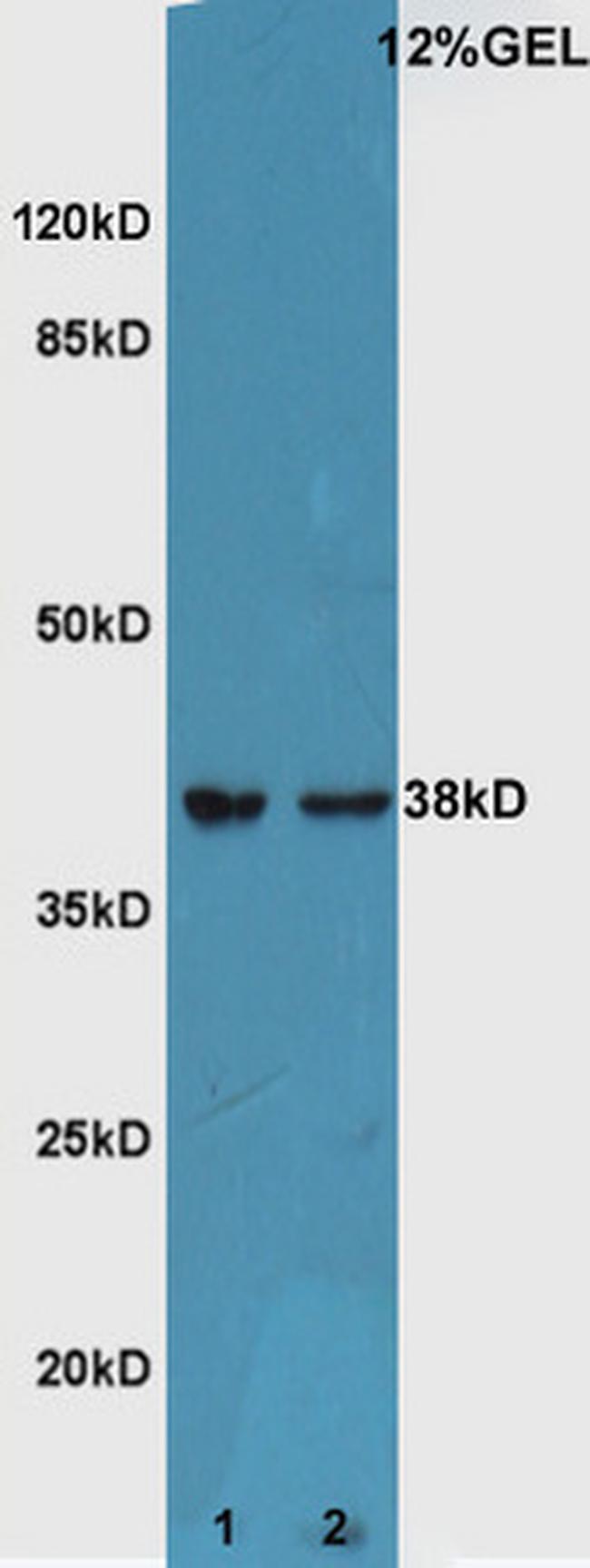 ATF4/CREB-2 Antibody in Western Blot (WB)