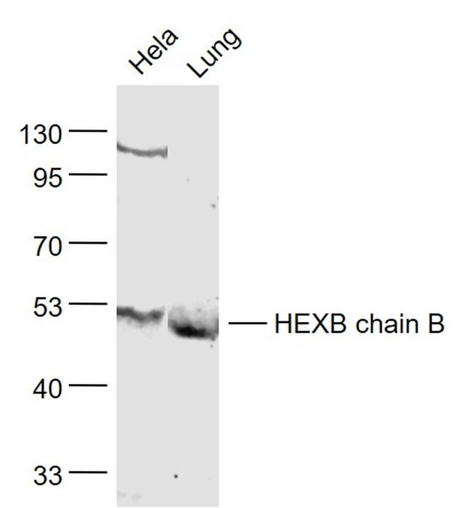 HEXB chain B Antibody in Western Blot (WB)