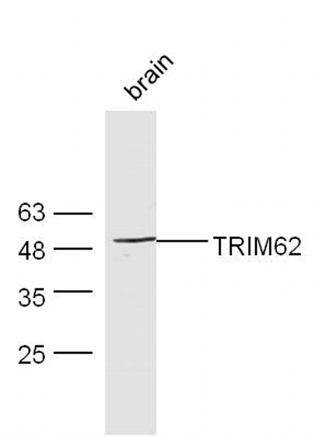TRIM62 Antibody in Western Blot (WB)