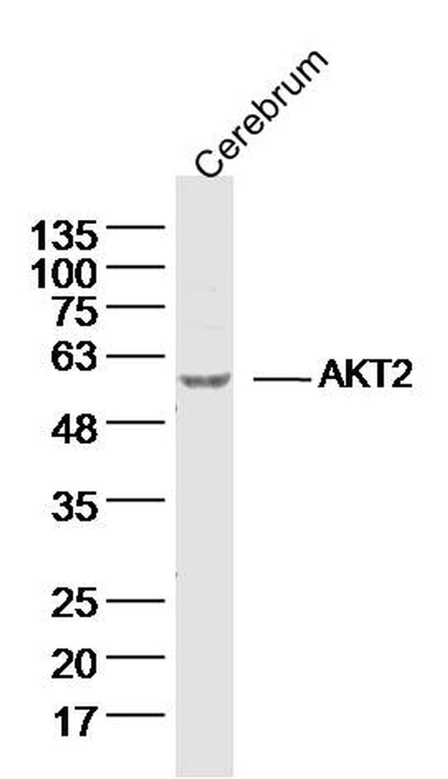 AKT2 Antibody in Western Blot (WB)